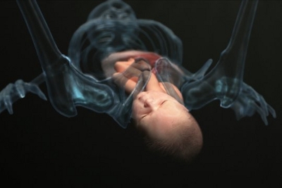 Accouchement du bébé, vue en transparence